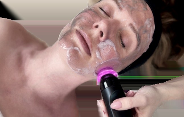 An advanced facial treatment in progress